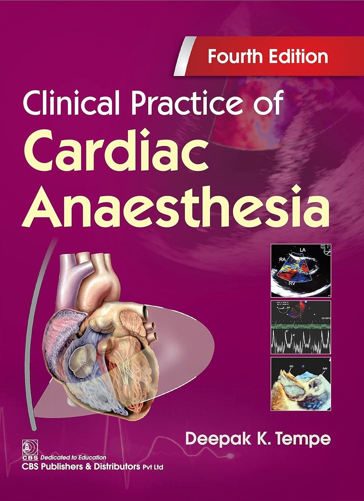 Clinical Practice of Cardiac Anaesthesia